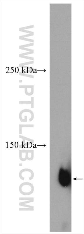 WB analysis of MDCK using 25869-1-AP