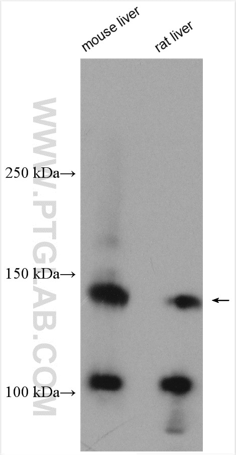 Western Blot (WB) analysis of various lysates using c-Met (Cytoplasmic) Polyclonal antibody (25869-1-AP)