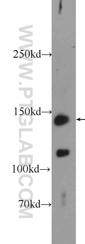 Western Blot (WB) analysis of A431 cells using c-Met (Cytoplasmic) Polyclonal antibody (25869-1-AP)