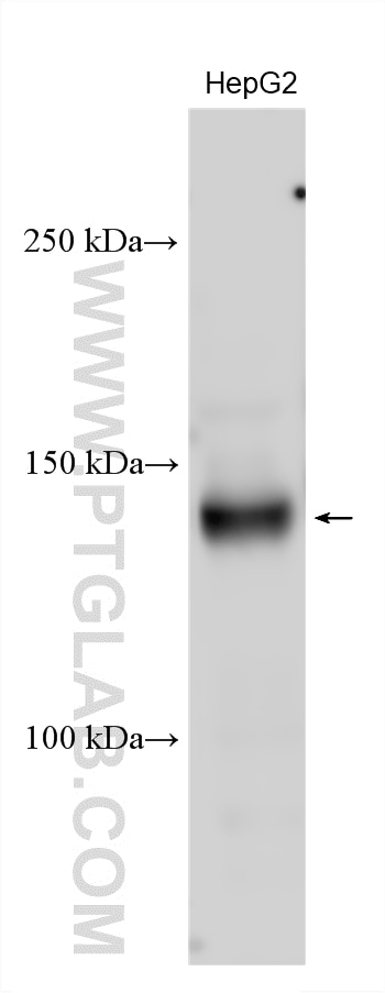 Western Blot (WB) analysis of various lysates using c-Met (Cytoplasmic) Polyclonal antibody (25869-1-AP)