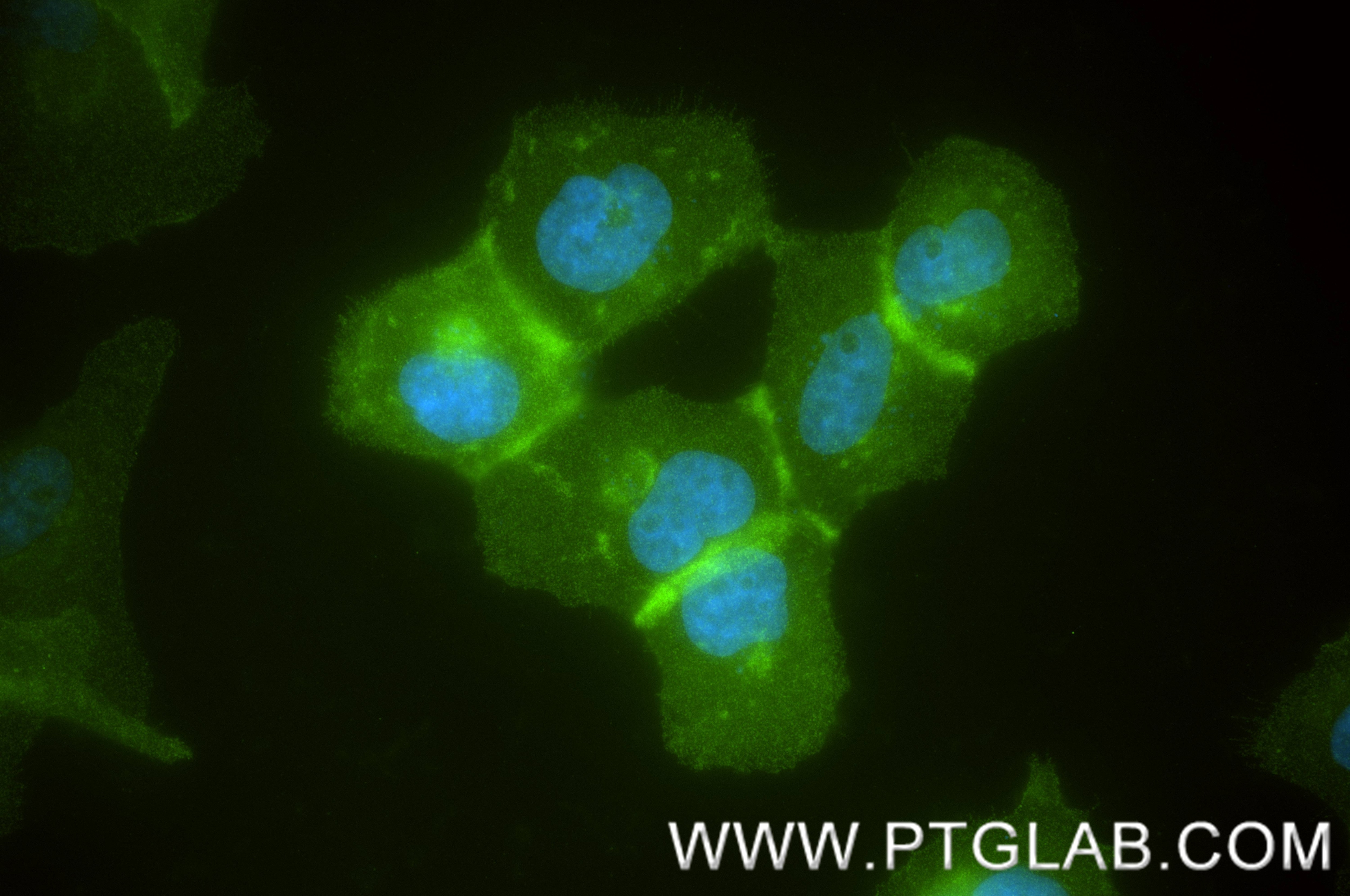 IF Staining of A431 using 82904-4-RR (same clone as 82904-4-PBS) Immunofluorescence (IF) / fluorescent staining of A431 cells using c-MET Recombinant monoclonal antibody (82904-4-RR)