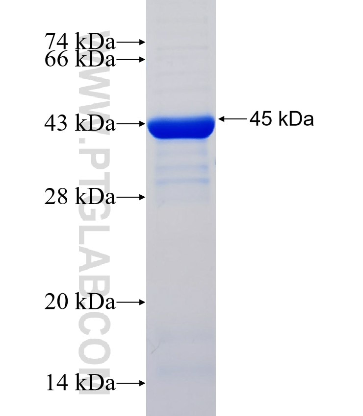 MET fusion protein Ag23140 SDS-PAGE