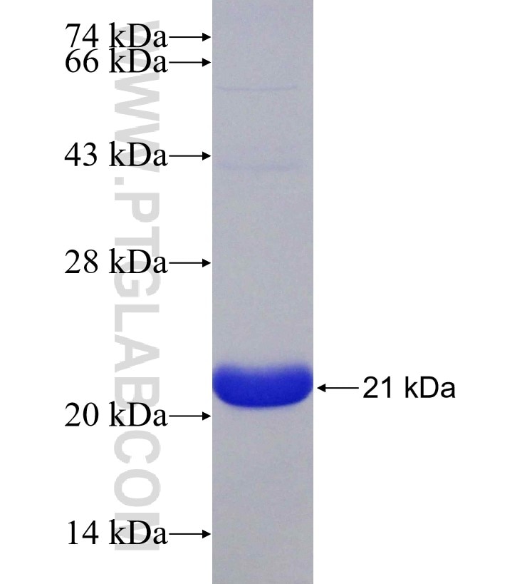 MET fusion protein Ag23141 SDS-PAGE