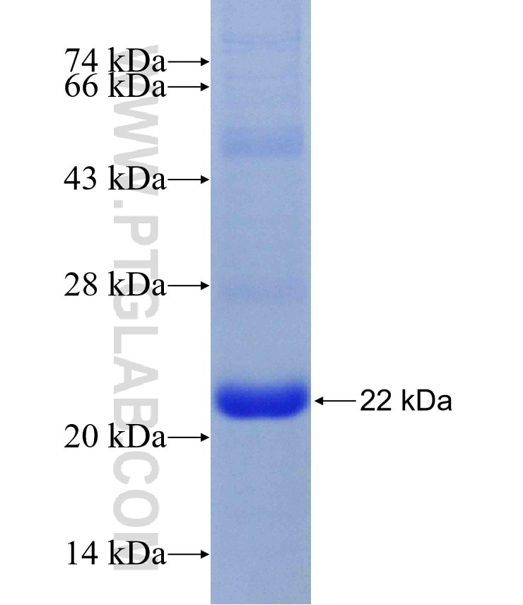 METAP1 fusion protein Ag29828 SDS-PAGE