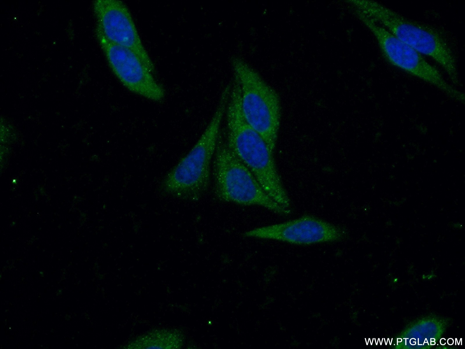 Immunofluorescence (IF) / fluorescent staining of HepG2 cells using METAP2 Polyclonal antibody (17040-1-AP)
