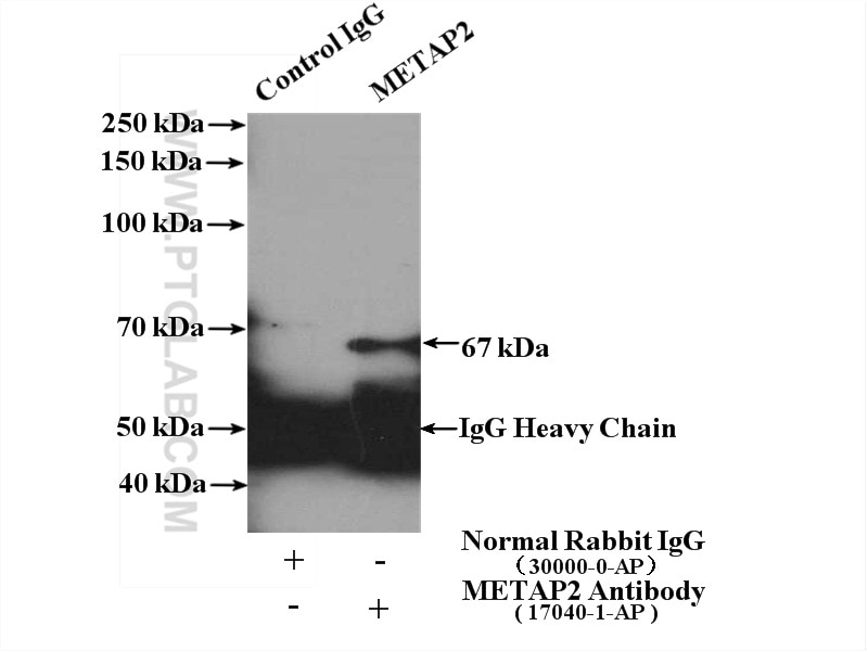 Immunoprecipitation (IP) experiment of MCF-7 cells using METAP2 Polyclonal antibody (17040-1-AP)