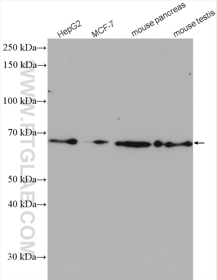 Western Blot (WB) analysis of various lysates using METAP2 Polyclonal antibody (17040-1-AP)