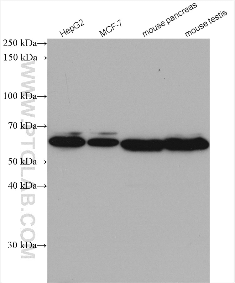 Western Blot (WB) analysis of various lysates using METAP2 Polyclonal antibody (17040-1-AP)