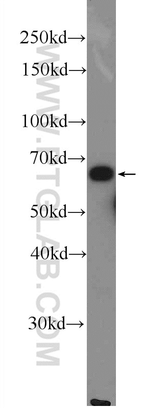 Western Blot (WB) analysis of MCF-7 cells using METAP2 Polyclonal antibody (17040-1-AP)