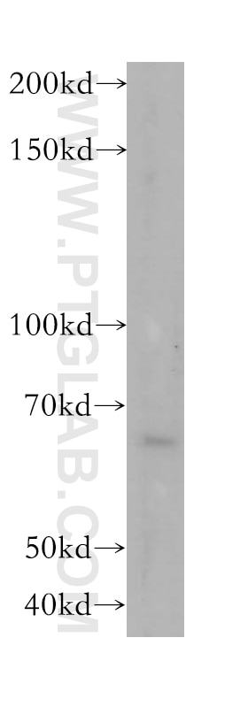 Western Blot (WB) analysis of HepG2 cells using METAP2 Polyclonal antibody (17040-1-AP)