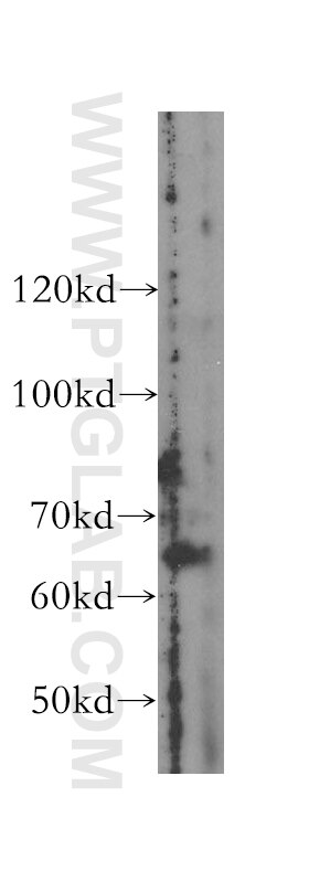 Western Blot (WB) analysis of MCF-7 cells using METAP2 Polyclonal antibody (17040-1-AP)