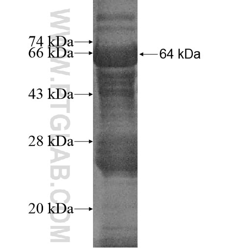 METAP2 fusion protein Ag10564 SDS-PAGE