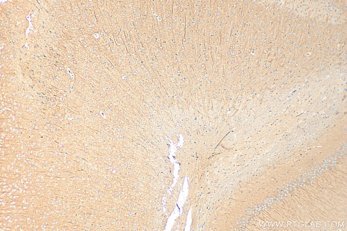 Immunohistochemistry (IHC) staining of mouse brain tissue using METRN Polyclonal antibody (16327-1-AP)