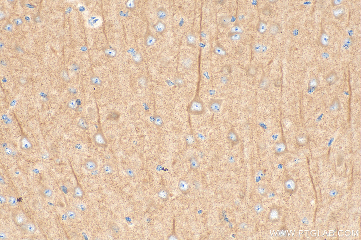 Immunohistochemistry (IHC) staining of mouse brain tissue using METRN Polyclonal antibody (16327-1-AP)