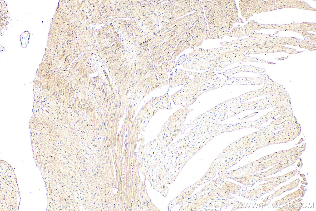 Immunohistochemistry (IHC) staining of mouse heart tissue using METRN Polyclonal antibody (16327-1-AP)