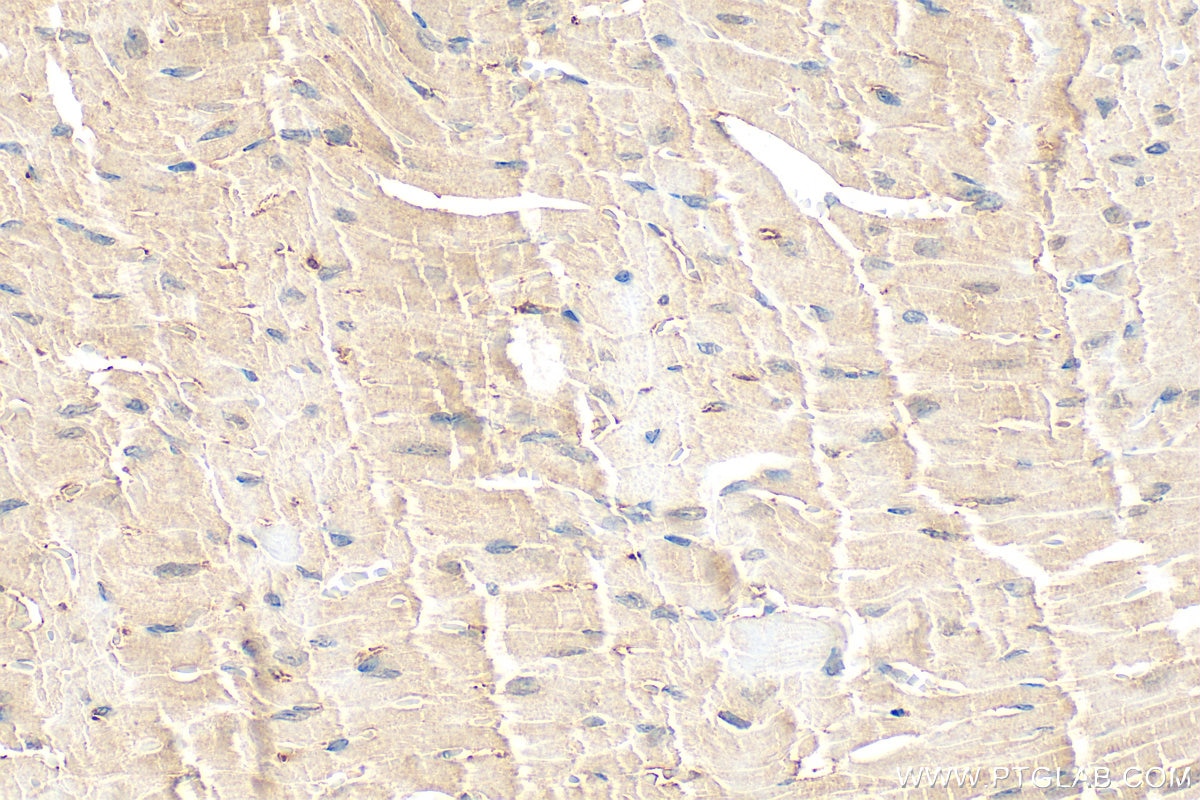 Immunohistochemistry (IHC) staining of mouse heart tissue using METRN Polyclonal antibody (16327-1-AP)