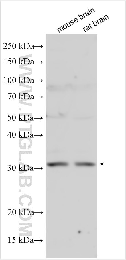 Western Blot (WB) analysis of various lysates using METRN Polyclonal antibody (16327-1-AP)