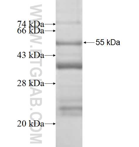 METRN fusion protein Ag9414 SDS-PAGE