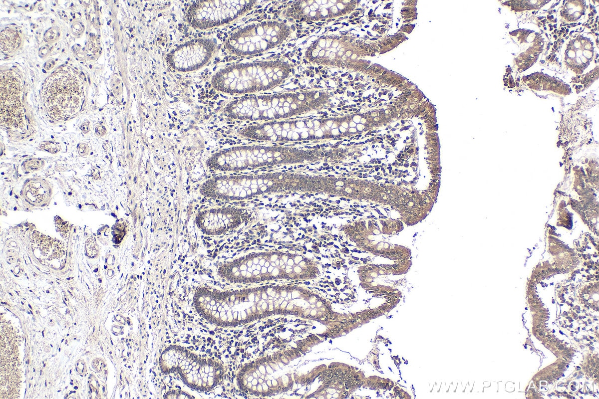 Immunohistochemistry (IHC) staining of human colon tissue using METTL16 Polyclonal antibody (19924-1-AP)