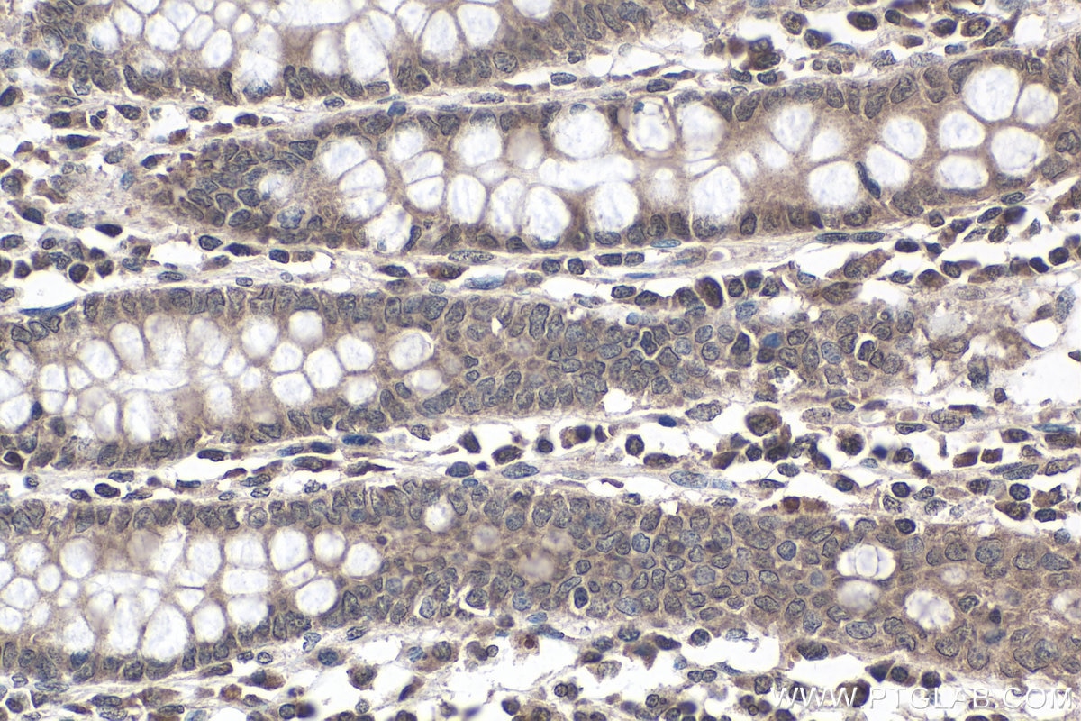 IHC staining of human colon using 19924-1-AP