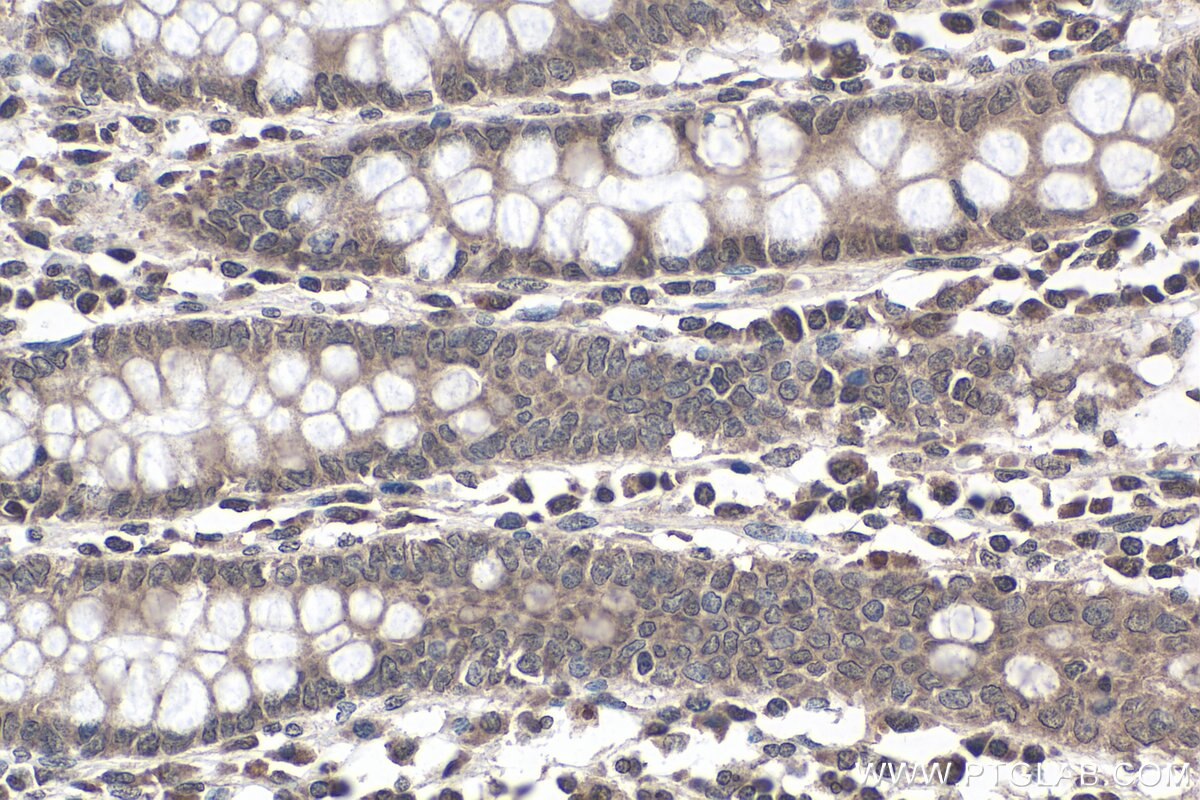 Immunohistochemistry (IHC) staining of human colon tissue using METTL16 Polyclonal antibody (19924-1-AP)