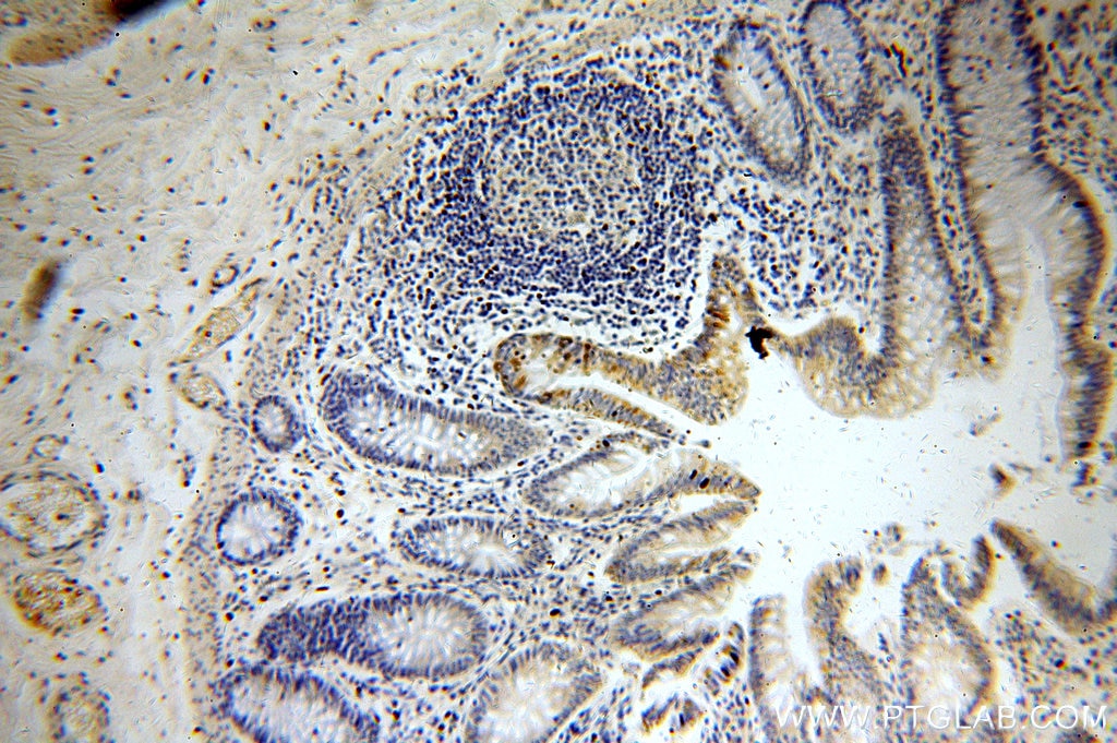 Immunohistochemistry (IHC) staining of human colon tissue using METTL16 Polyclonal antibody (19924-1-AP)