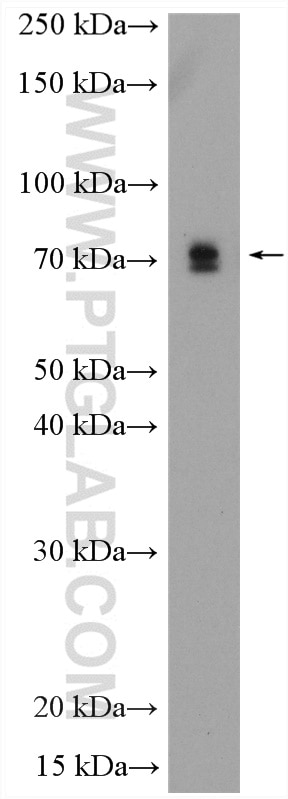 Western Blot (WB) analysis of rat testis tissue using METTL16 Polyclonal antibody (19924-1-AP)