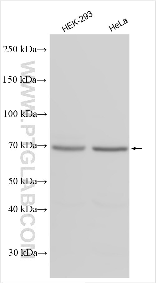 Western Blot (WB) analysis of various lysates using METTL16 Polyclonal antibody (19924-1-AP)