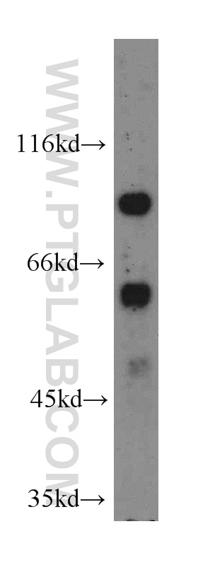 Western Blot (WB) analysis of HEK-293 cells using METTL16 Polyclonal antibody (19924-1-AP)
