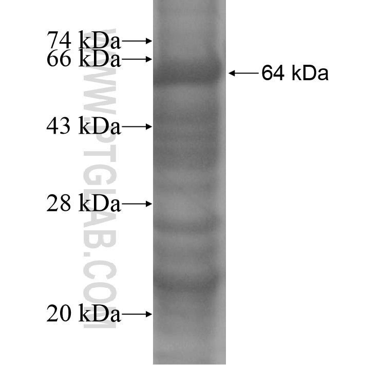 METT11D1 fusion protein Ag14518 SDS-PAGE METT11D1 fusion protein Ag14518 SDS-PAGE