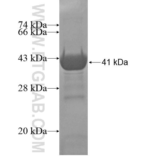 METT11D1 fusion protein Ag14727 SDS-PAGE