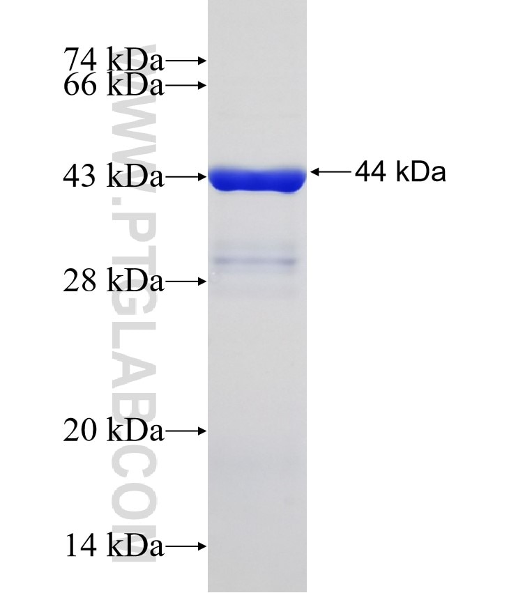 METT5D1 fusion protein Ag31863 SDS-PAGE