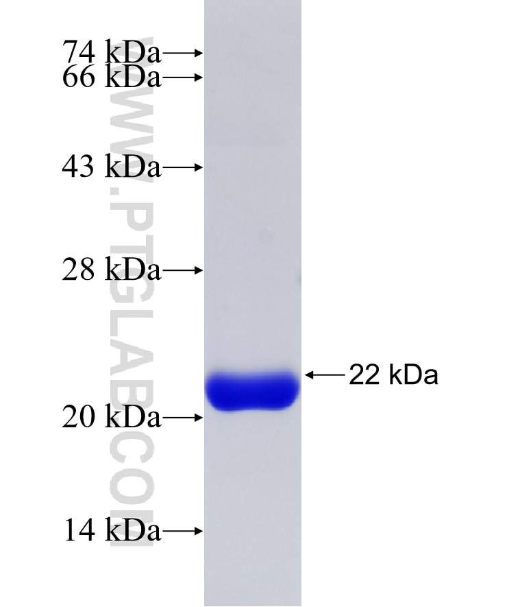 METT5D1 fusion protein Ag31876 SDS-PAGE METT5D1 fusion protein Ag31876 SDS-PAGE