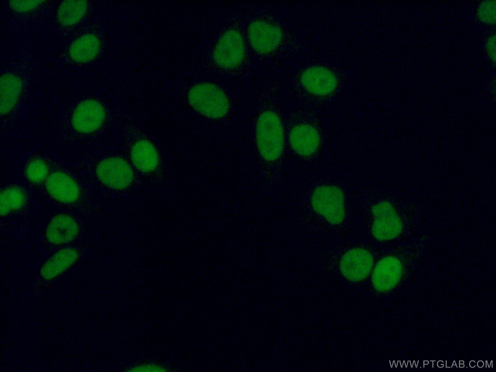 Immunofluorescence (IF) / fluorescent staining of HepG2 cells using METTL1 Polyclonal antibody (14994-1-AP)