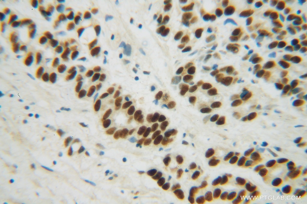 METTL1 Polyclonal antibody