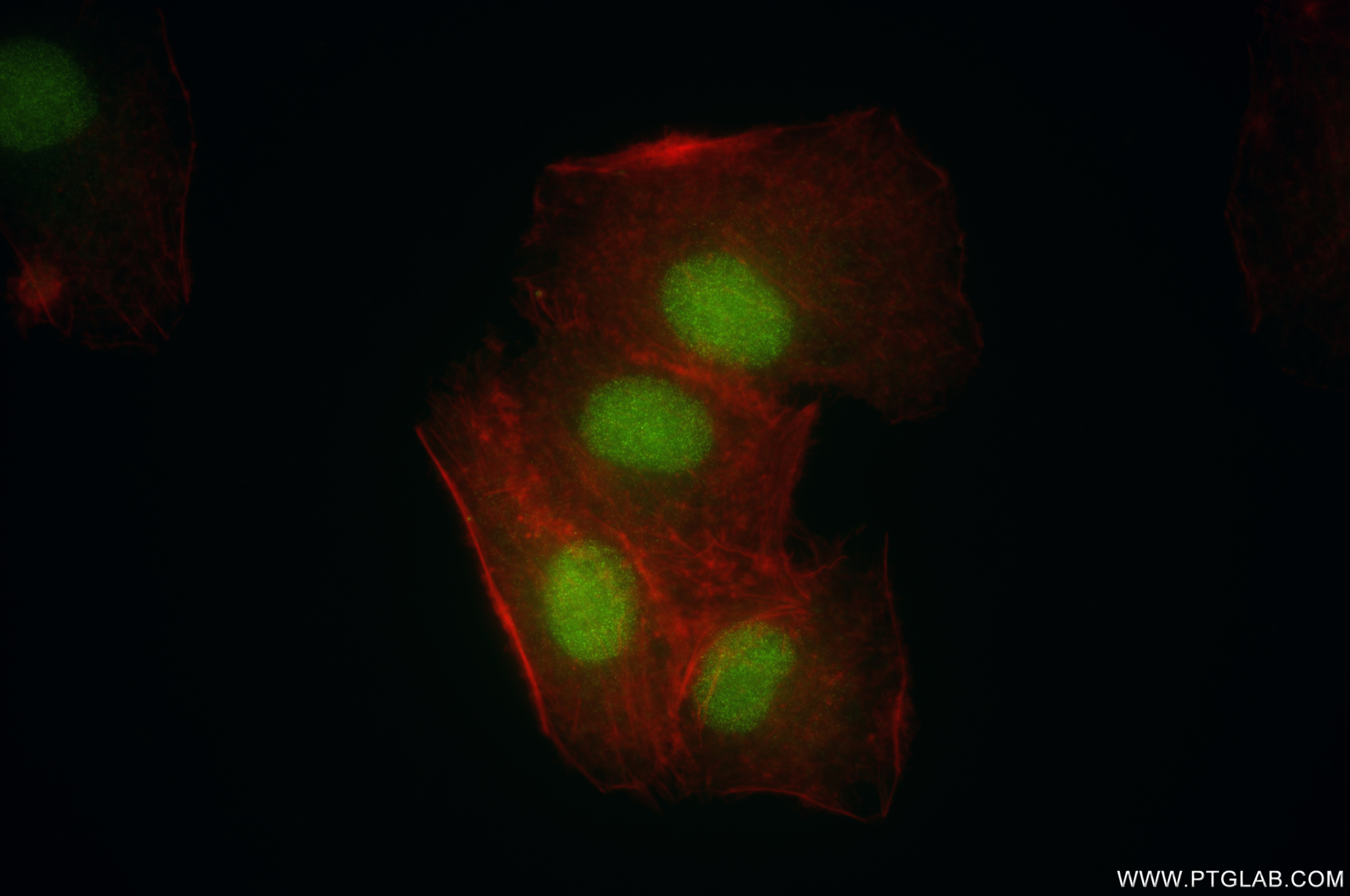 Immunofluorescence (IF) / fluorescent staining of A549 cells using METTL1 Recombinant antibody (84272-1-RR)