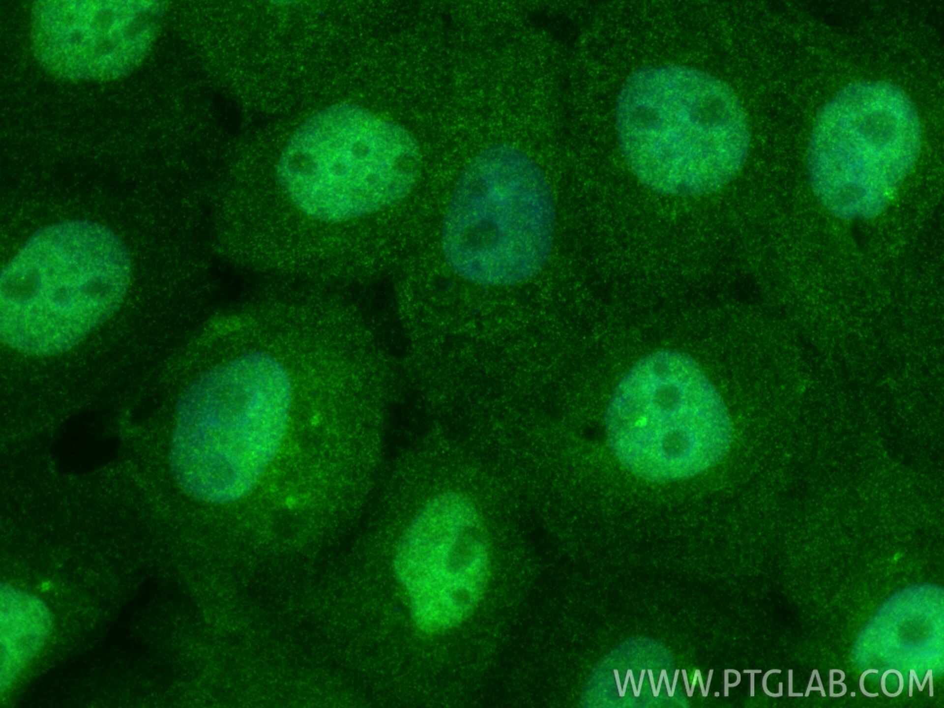 IF Staining of A431 using 33763-1-AP Immunofluorescence (IF) / fluorescent staining of A431 cells using METTL10 Polyclonal antibody (33763-1-AP)