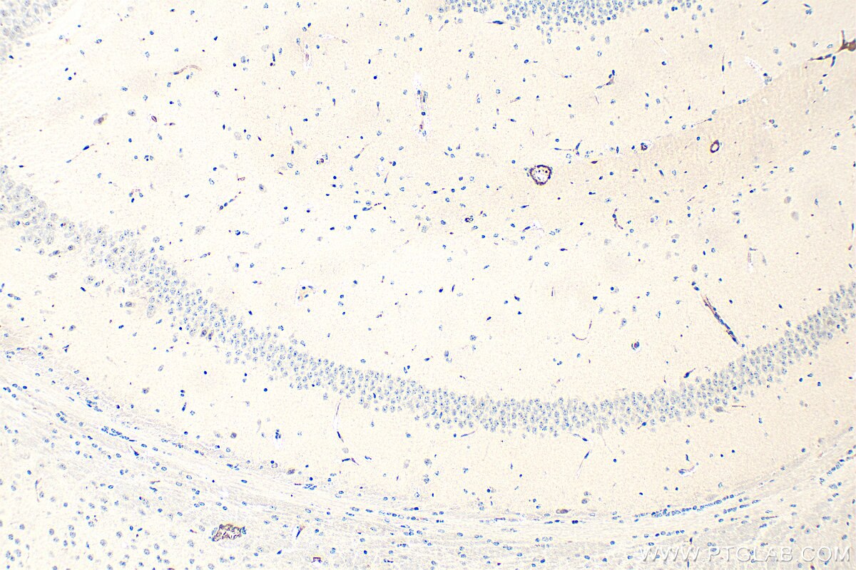 IHC staining of mouse brain using 33763-1-AP Immunohistochemistry (IHC) staining of mouse brain tissue using METTL10 Polyclonal antibody (33763-1-AP)