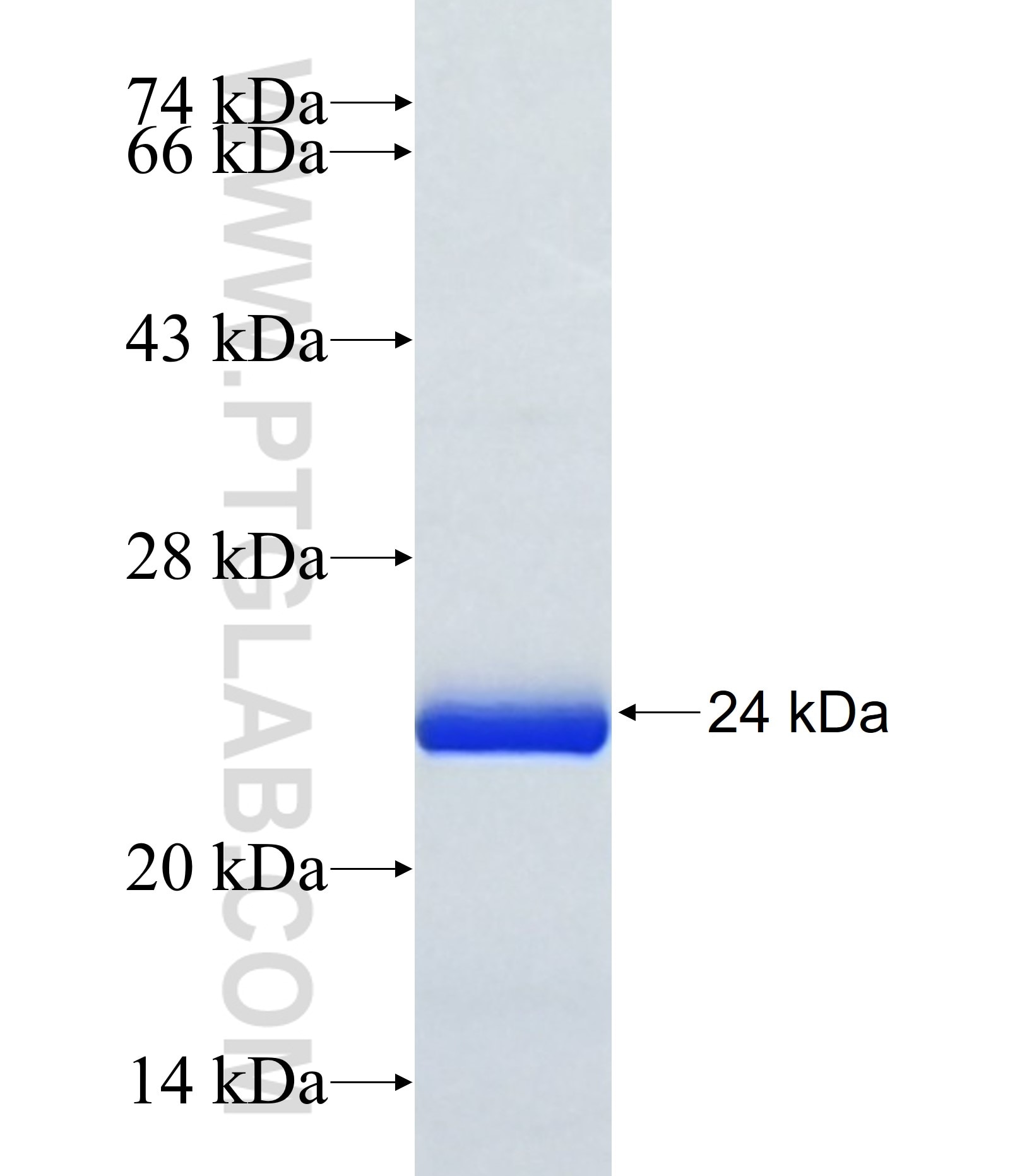 METTL10 fusion protein Ag37025 SDS-PAGE METTL10 fusion protein Ag37025 SDS-PAGE