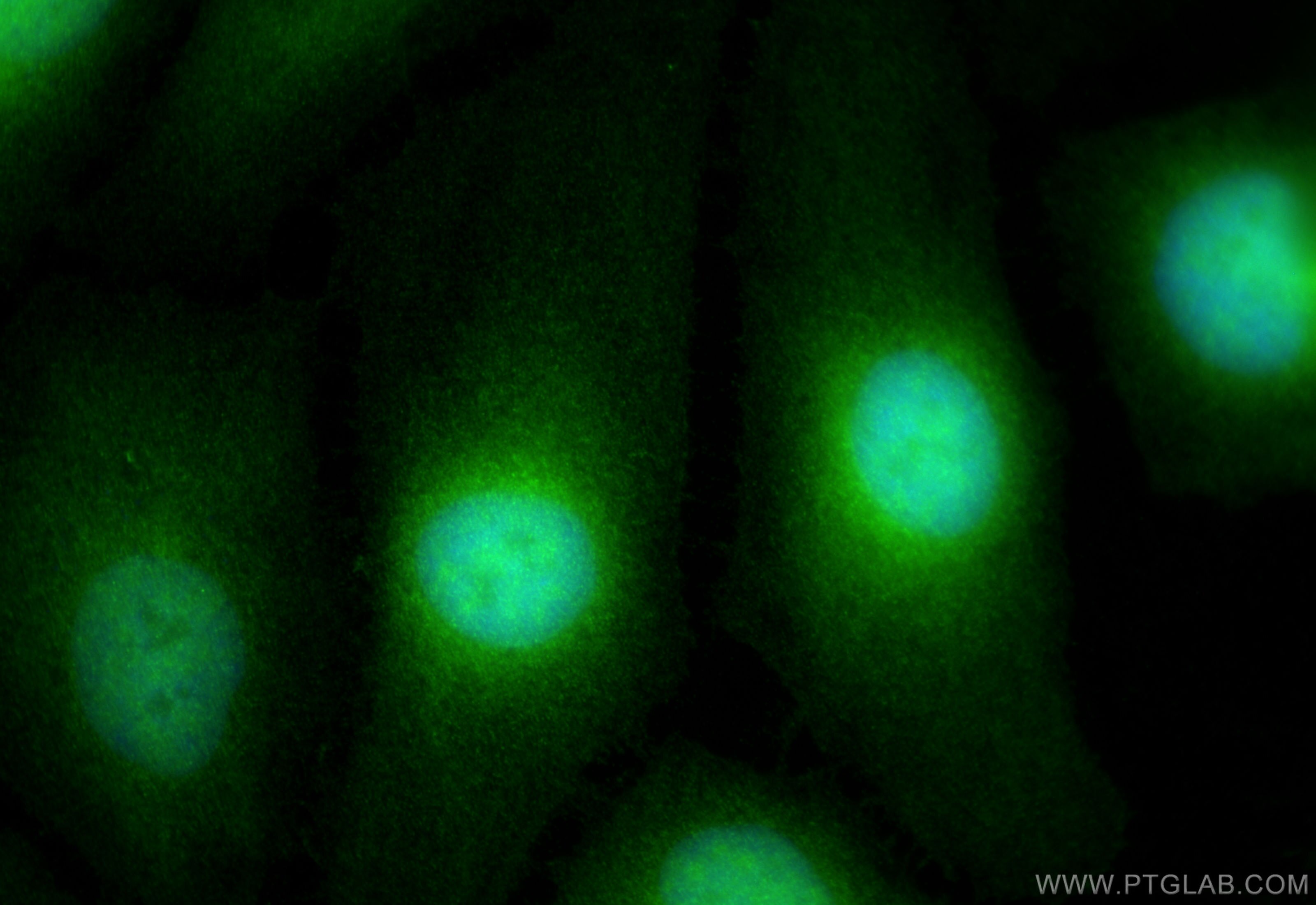 Immunofluorescence (IF) / fluorescent staining of HeLa cells using METTL11A Polyclonal antibody (17184-1-AP)