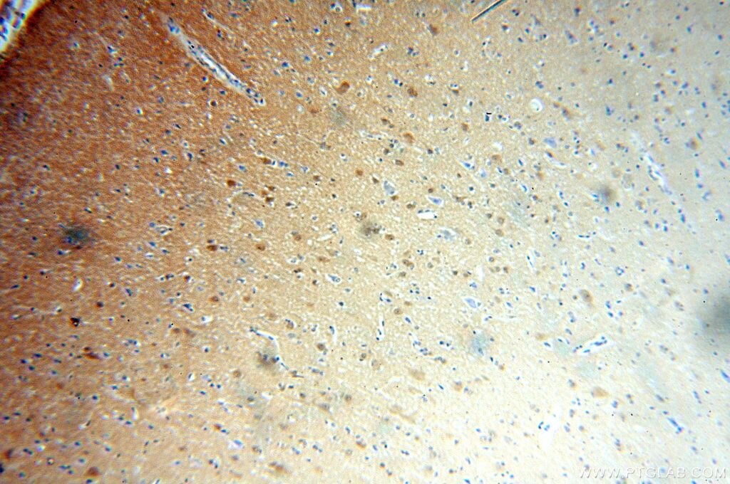 METTL11A