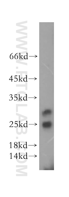 Western Blot (WB) analysis of mouse testis tissue using METTL11A Polyclonal antibody (17184-1-AP)