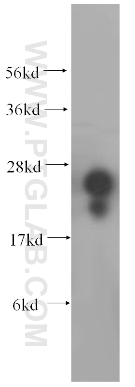 Western Blot (WB) analysis of HepG2 cells using METTL11A Polyclonal antibody (17184-1-AP)