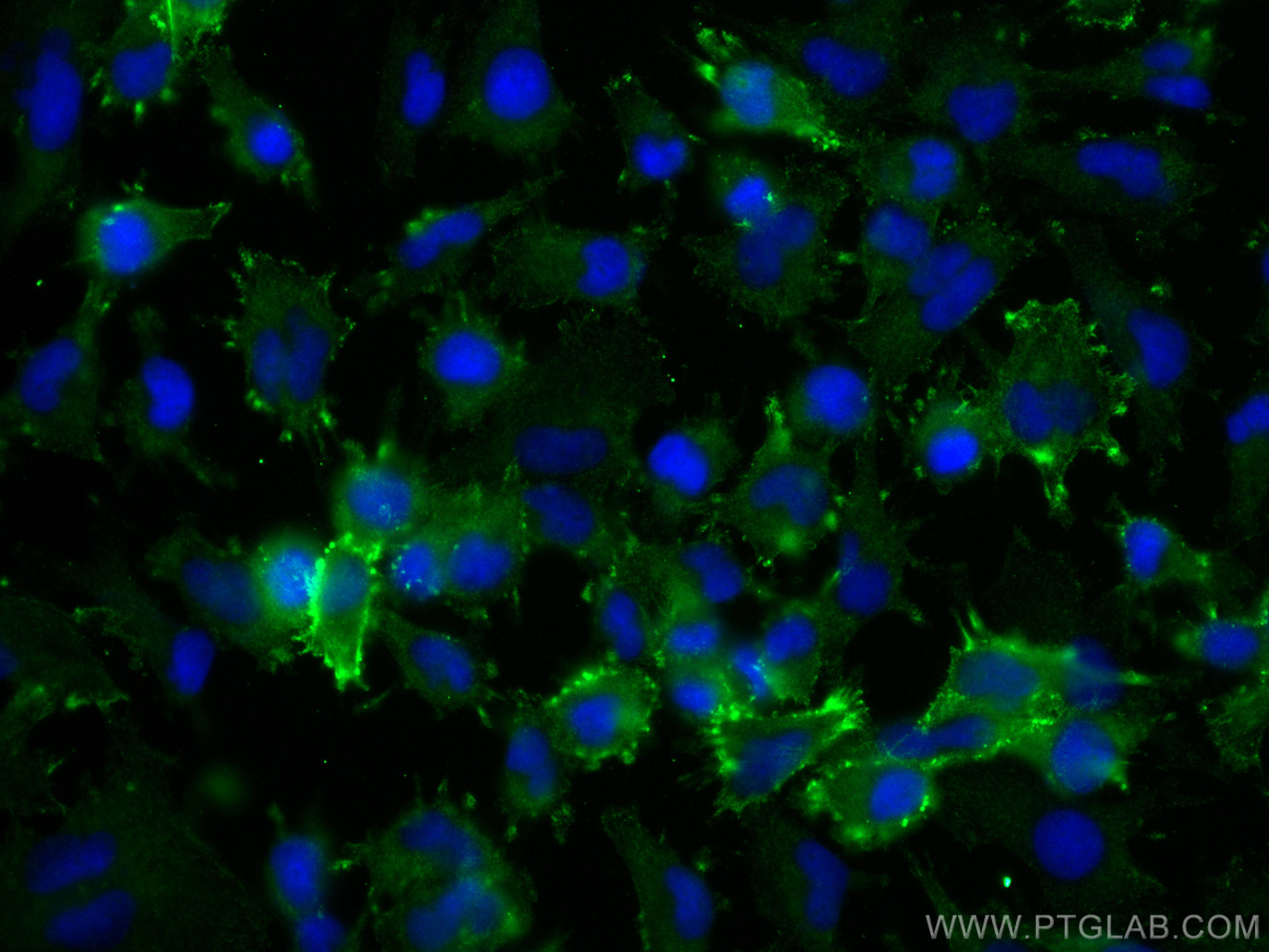 Immunofluorescence (IF) / fluorescent staining of U-251 cells using METTL13 Polyclonal antibody (24379-1-AP)