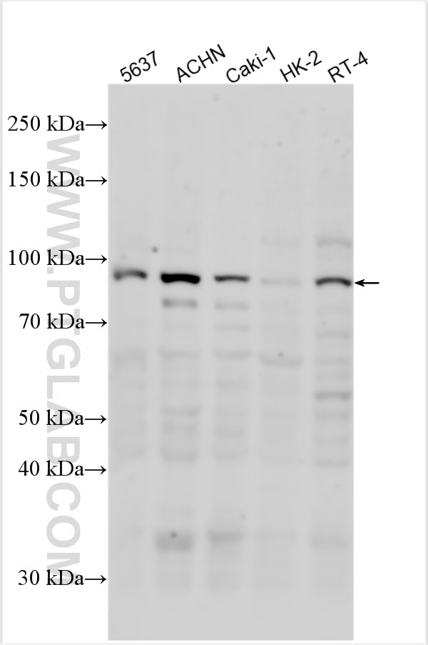 Western Blot (WB) analysis of various lysates using METTL13 Polyclonal antibody (24379-1-AP)