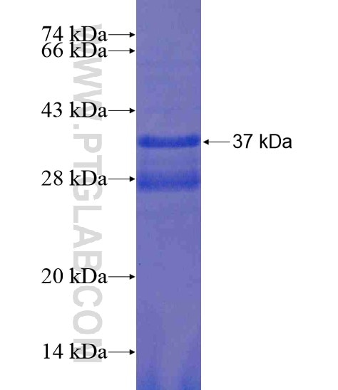 METTL13 fusion protein Ag19355 SDS-PAGE