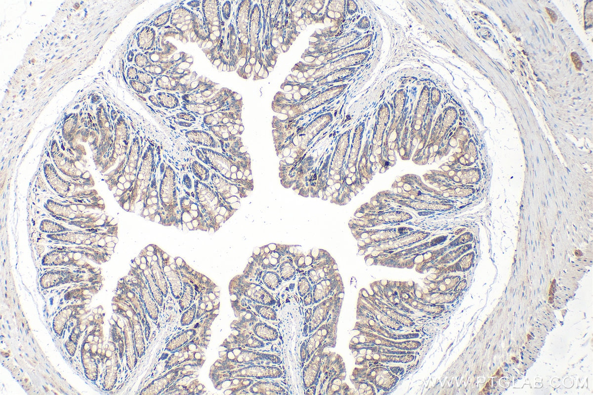IHC staining of mouse colon using 20890-1-AP Immunohistochemistry (IHC) staining of mouse colon tissue using METTL17 Polyclonal antibody (20890-1-AP)