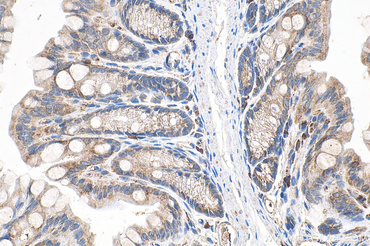 IHC staining of mouse colon using 20890-1-AP Immunohistochemistry (IHC) staining of mouse colon tissue using METTL17 Polyclonal antibody (20890-1-AP)