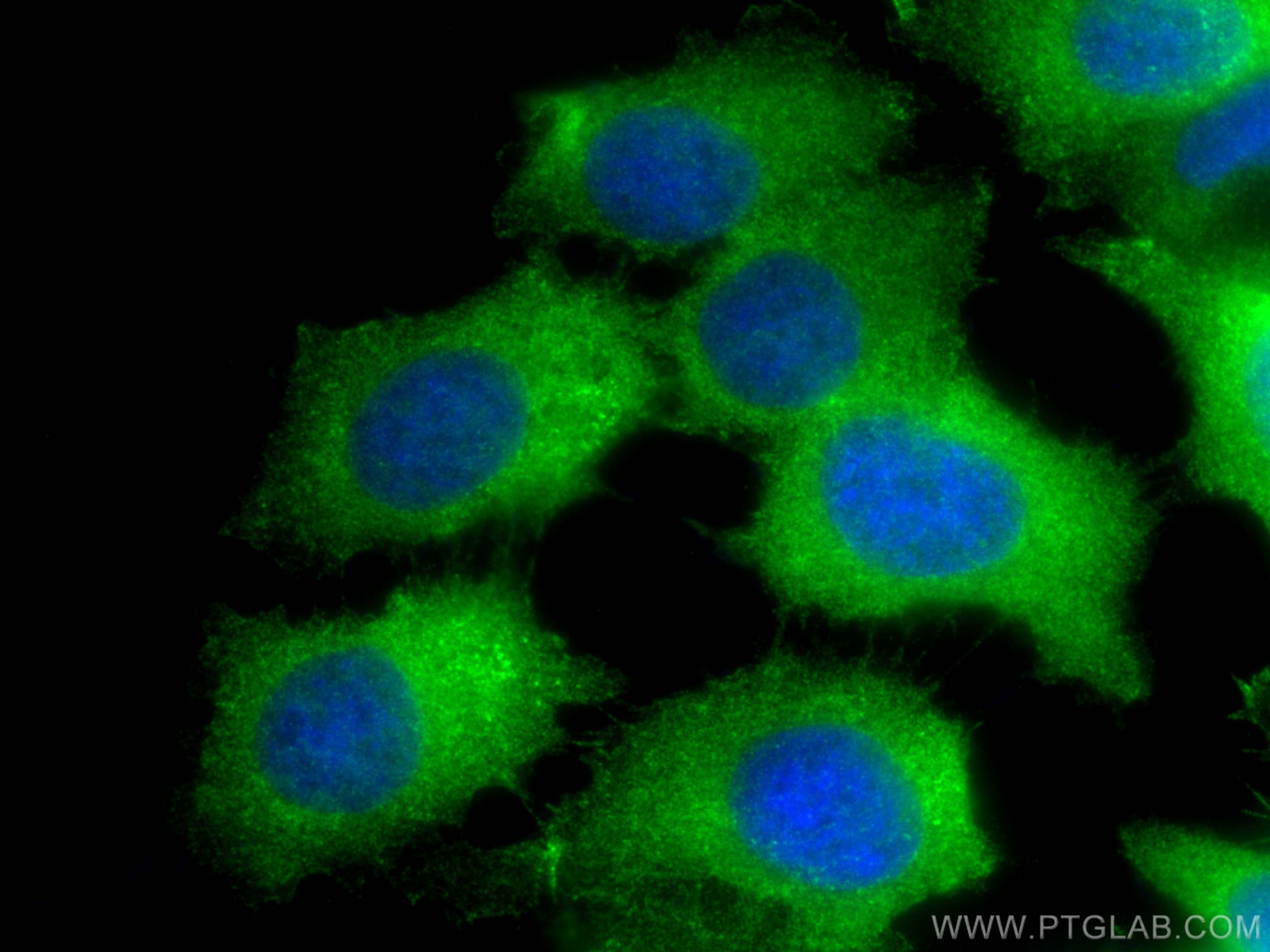 Immunofluorescence (IF) / fluorescent staining of MCF-7 cells using METTL2 Polyclonal antibody (16983-1-AP)