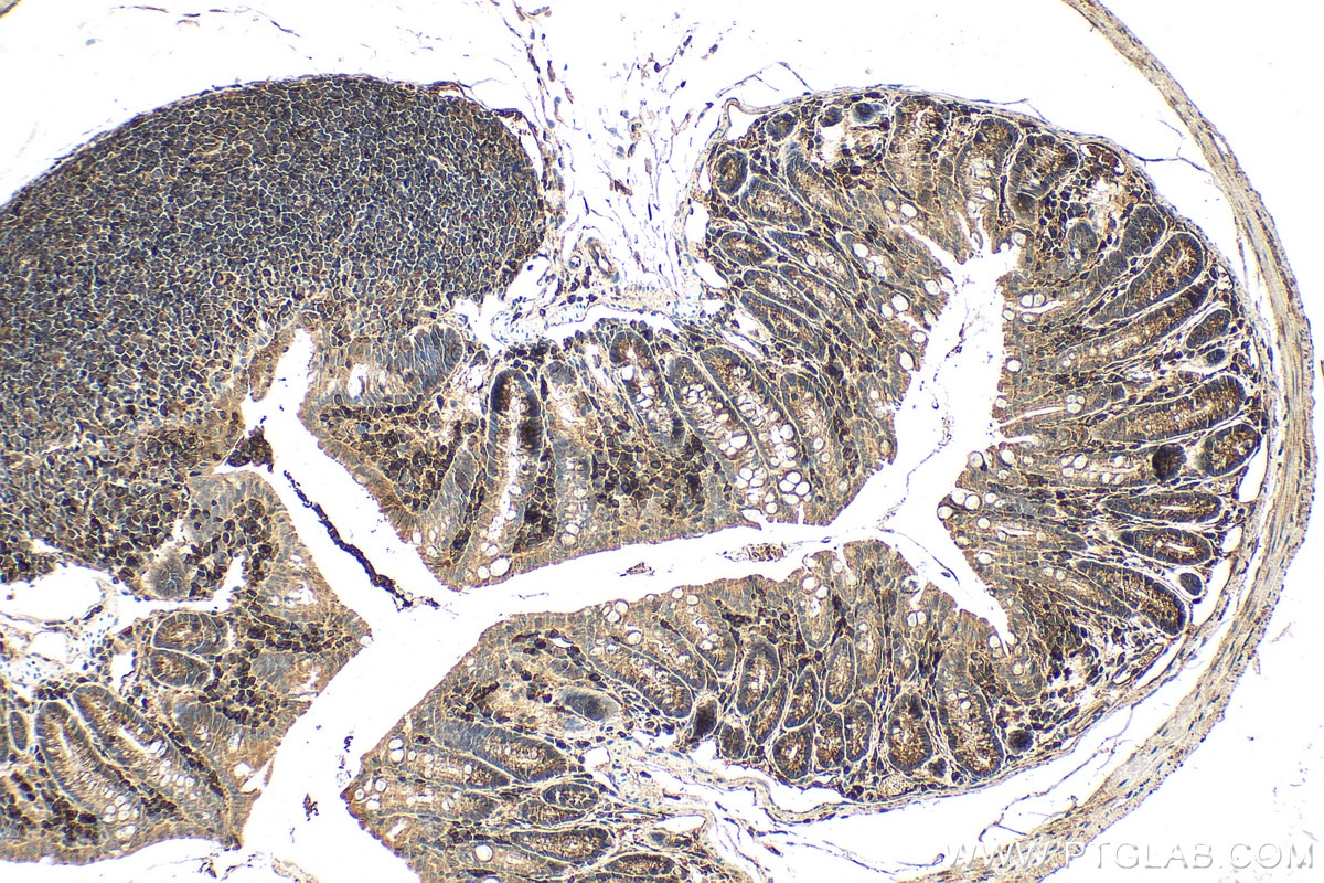 Immunohistochemistry (IHC) staining of mouse colon tissue using METTL2 Polyclonal antibody (16983-1-AP)